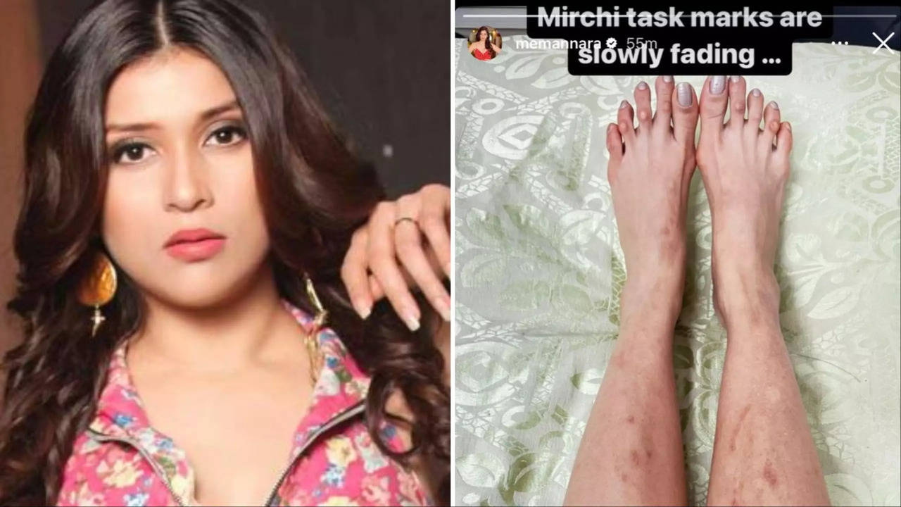 Mannara Chopra Still Recovering From Bigg Boss 17's Mirchi Task; Shares Health Update