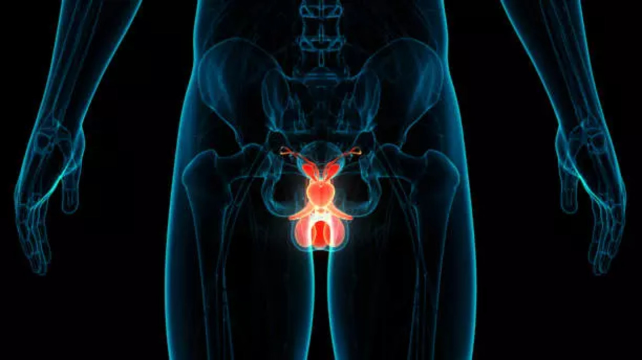 prostate cancer