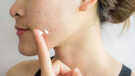 Cancer-causing Benzene Found In Clinique Clearasil Acne Products US Lab Reports