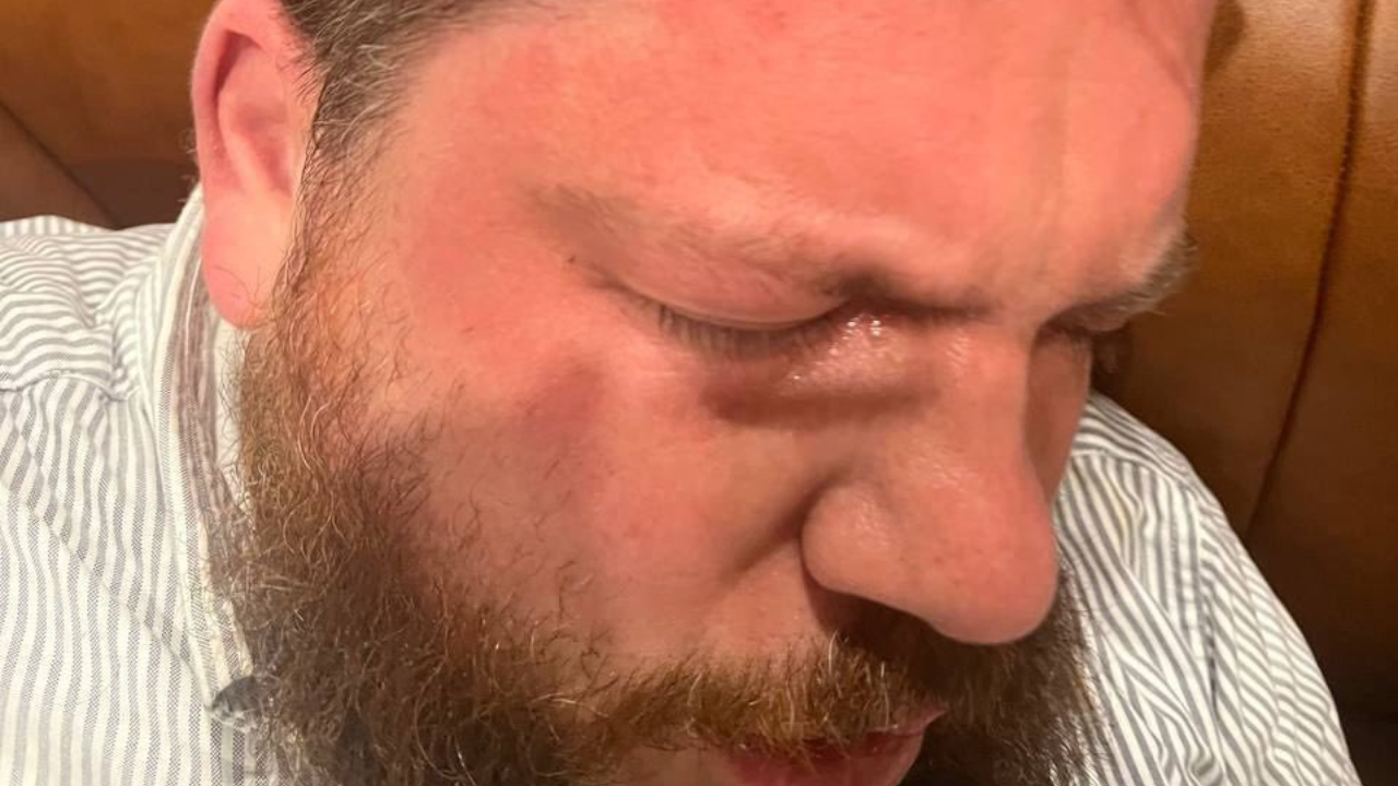 Leonid Volkov, Alexei Navalny Advisor, Injured Attack