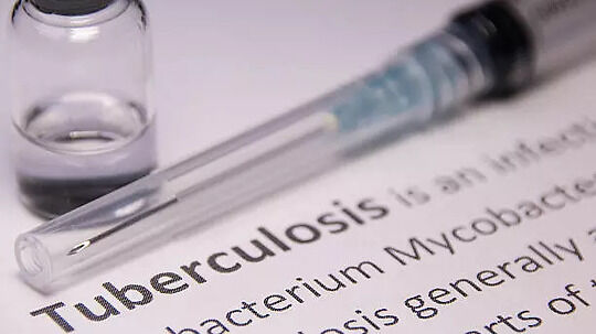 World Tuberculosis Day 2024 Can Improved Nutrition Reduce TB