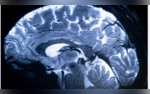 Meet Iseult Worlds Strongest MRI Scanner Shows First Human Brain Scans