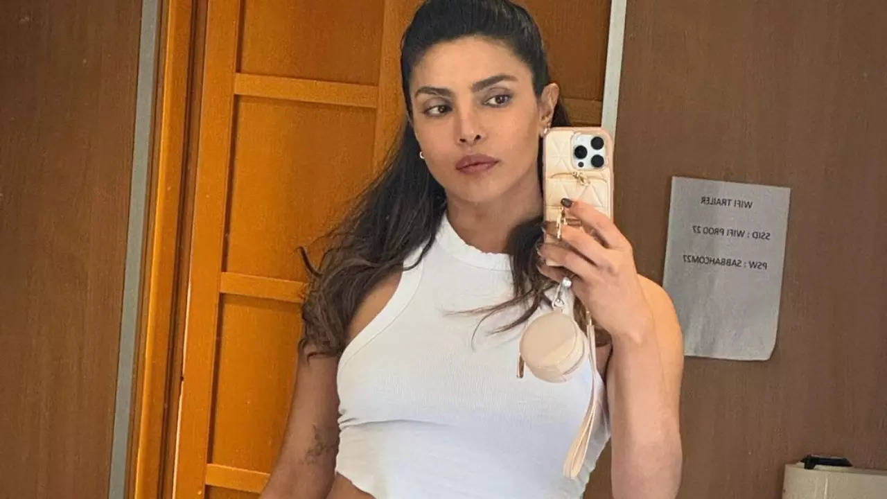 Priyanka Chopra Shares Photo Of Bloodied Forehead From Heads of State Set