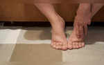 Swelling To Itching 6 Signs of Kidney Disease Detected on Feet