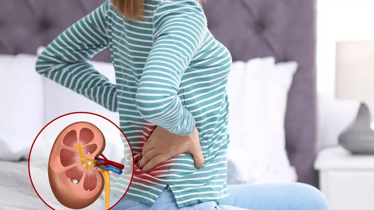 Kidney stone symptoms