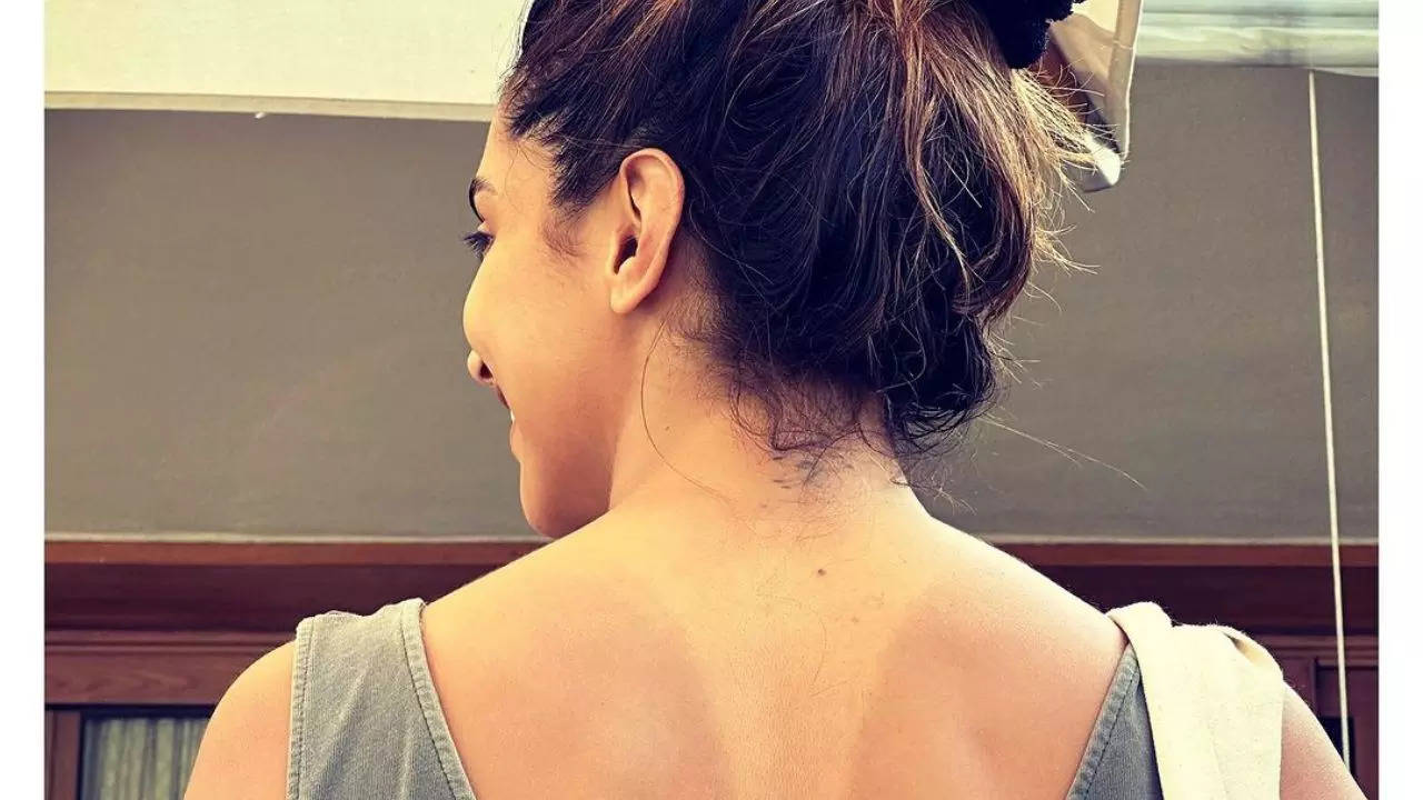 How to treat sunburned skin? (Image - Instagram)