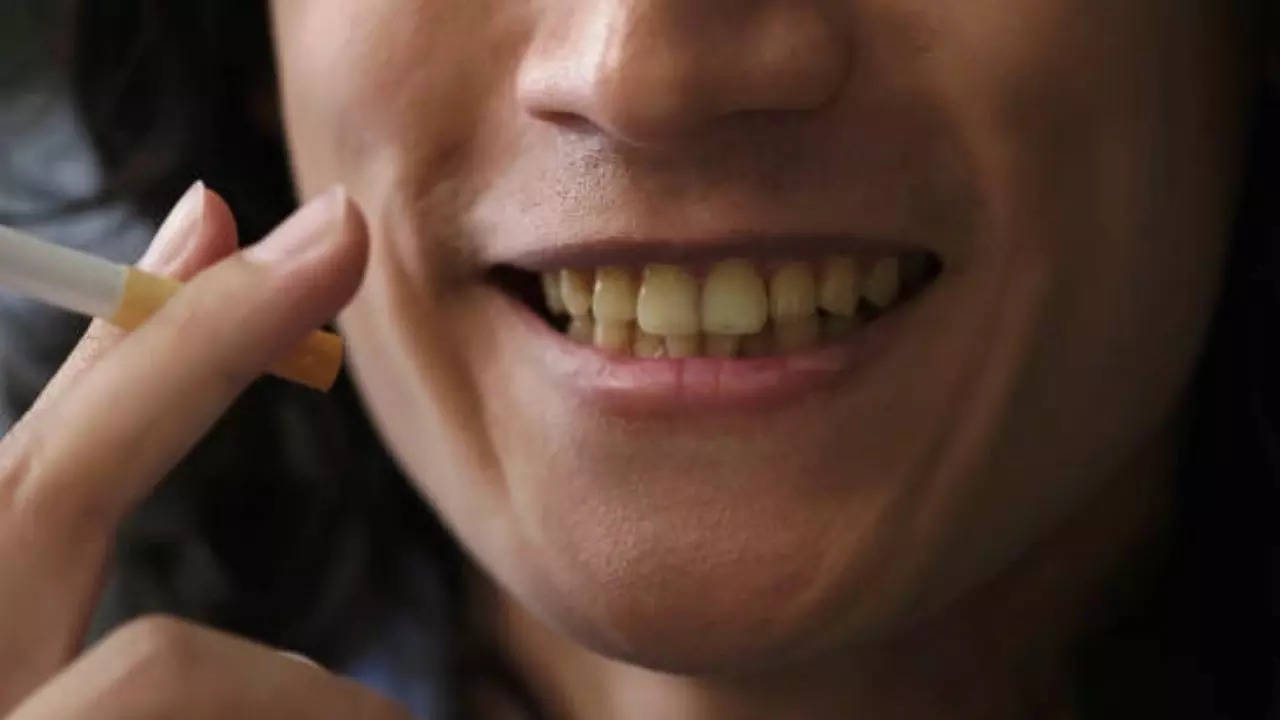 Is Smoking Leaving Ugly Stains On Your Teeth?