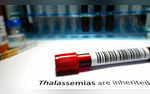 World Thalassemia Day Date Theme History And Significance Of The Day