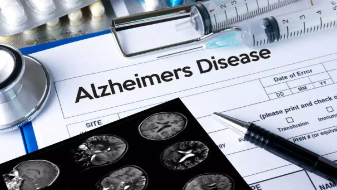 Alzheimer's disease