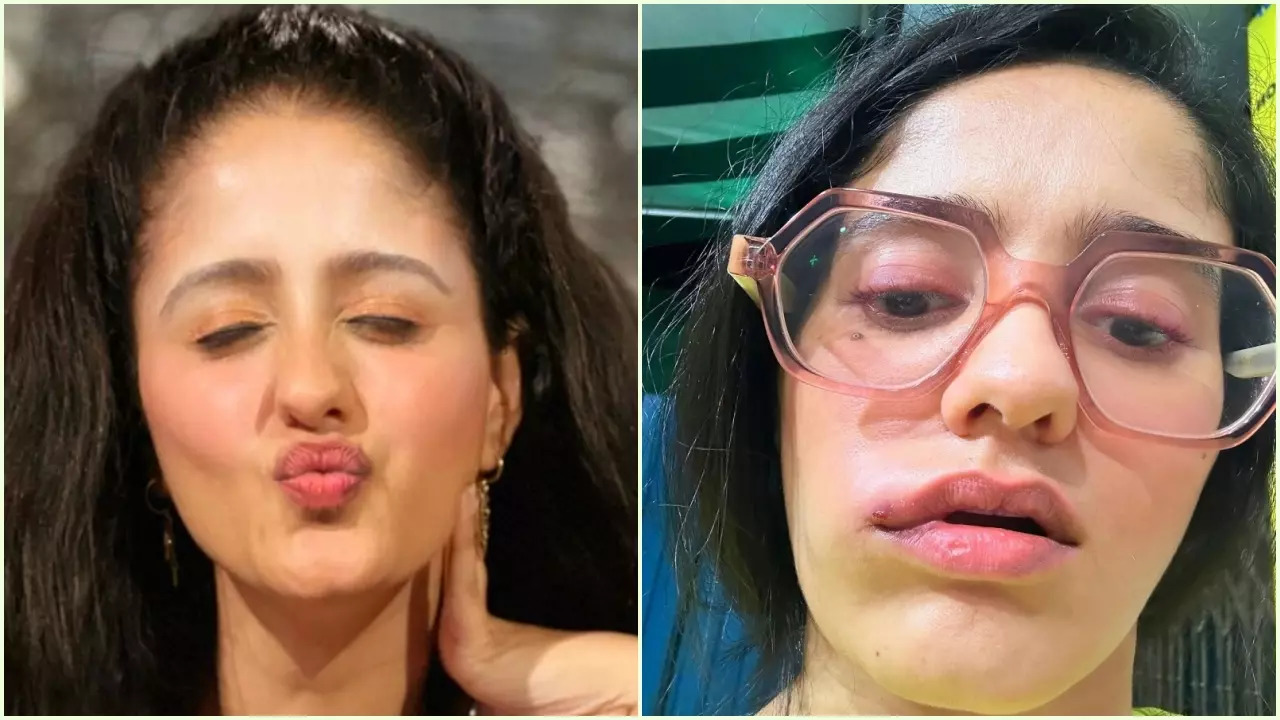 GHKPM Fame Ayesha Singh Is Unwell, Netizens Get Worried Seeing Her Swollen Face