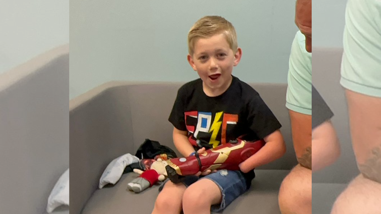 5-year-old gets ‘iron man’ themed prosthetic arm, becomes youngest recipient of bionic hand