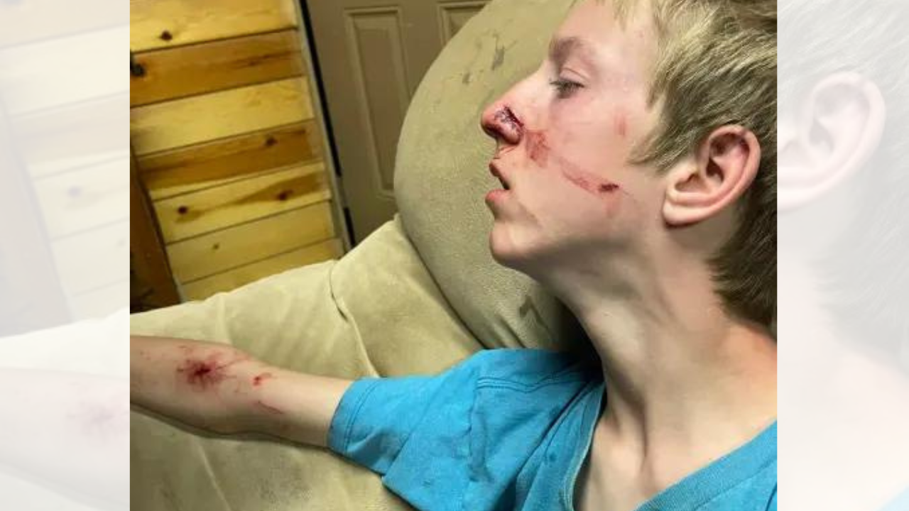 15-Year-Old US Boy Attacked By Bear In Arizona