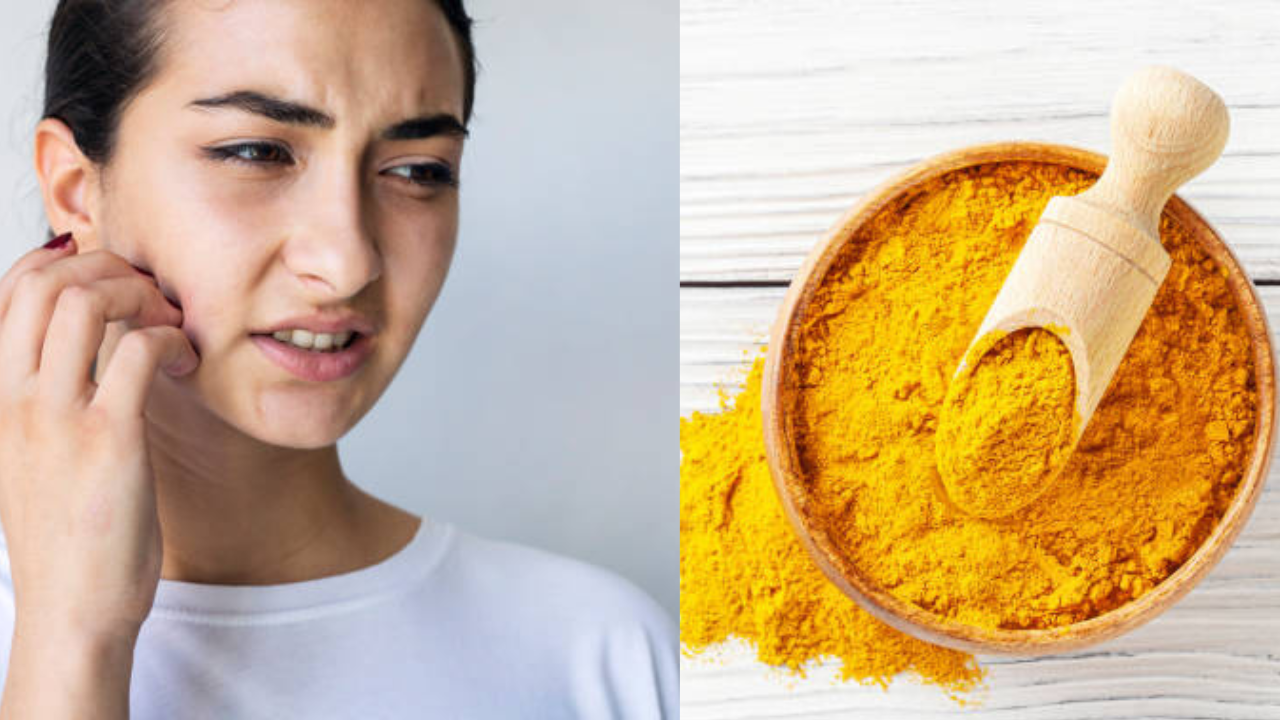 excessive uses of turmeric causes skin problems turmeric side effect