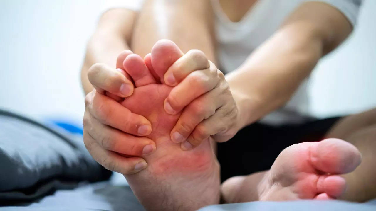 Gout Cases Surge By 1,000% In England