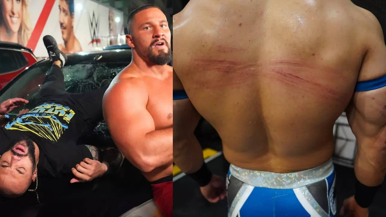 ex-us champion sustains multiple upper body injuries, wwe clears the air around his future