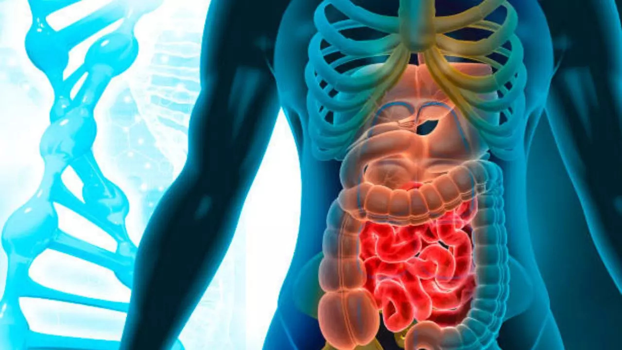 bowel cancer breakthrough