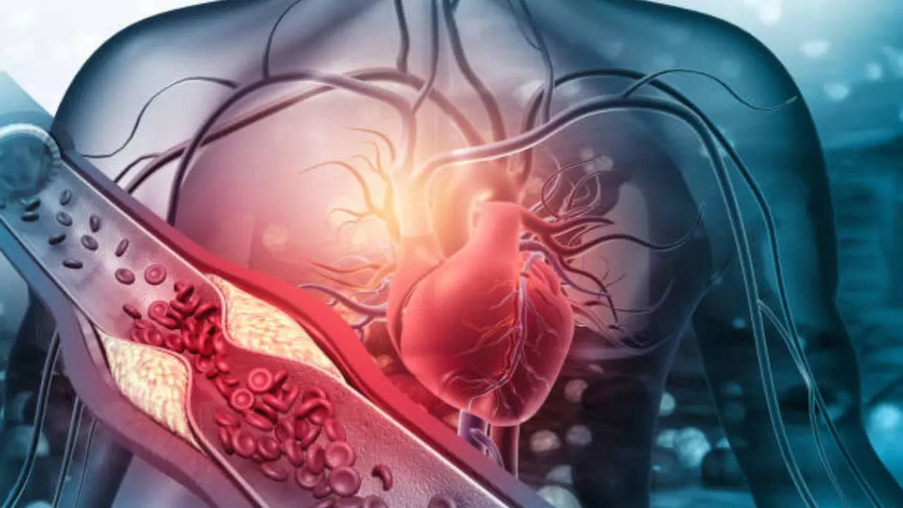 Radial angioplasty