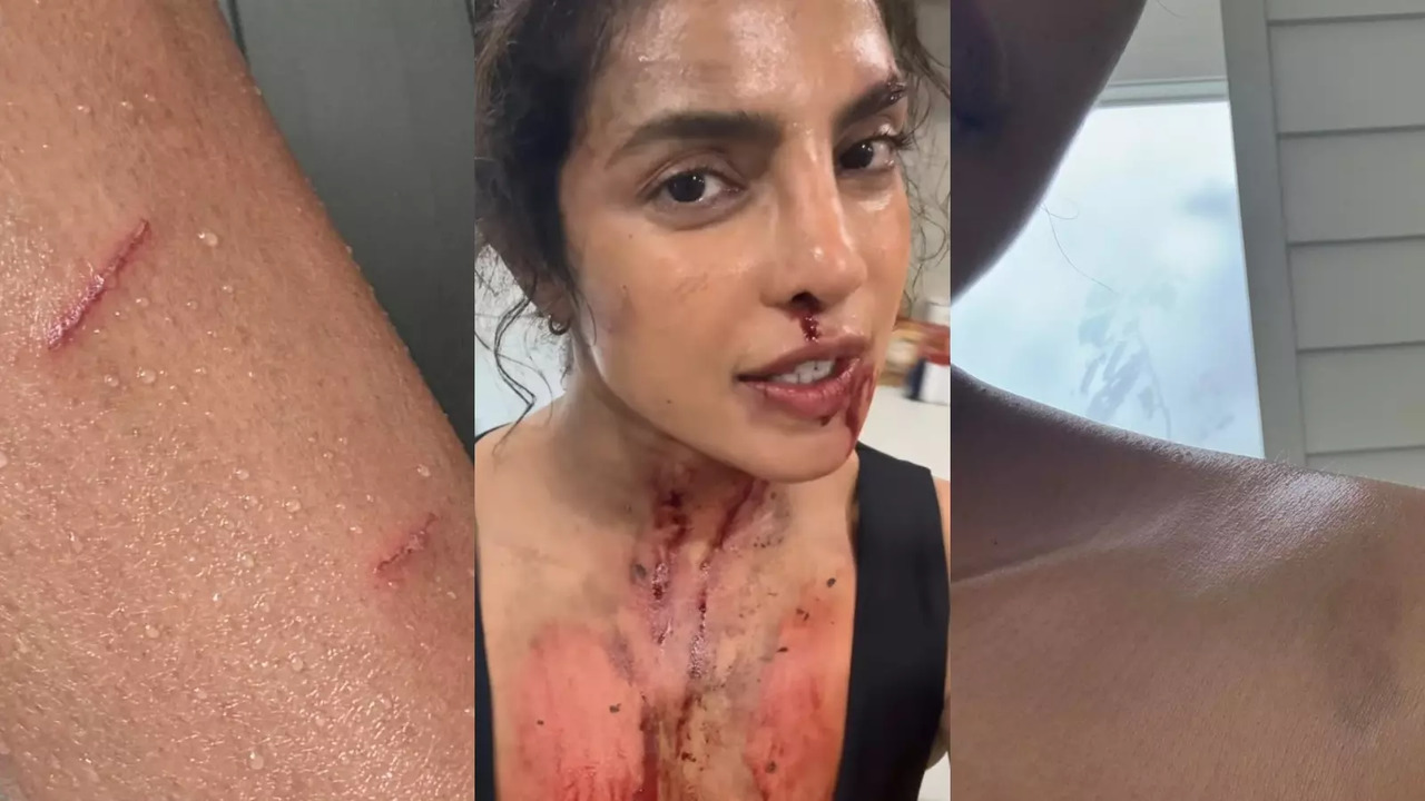 Priyanka Chopra Shares Glimpse Of Her Life 'Lately', Flaunts Bloodied Clip From The Bluff Sets