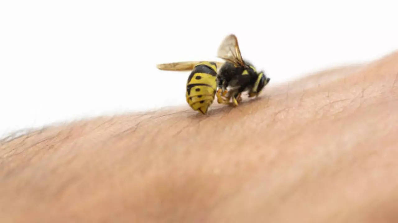 Easy ways to treat honeybee sting at home