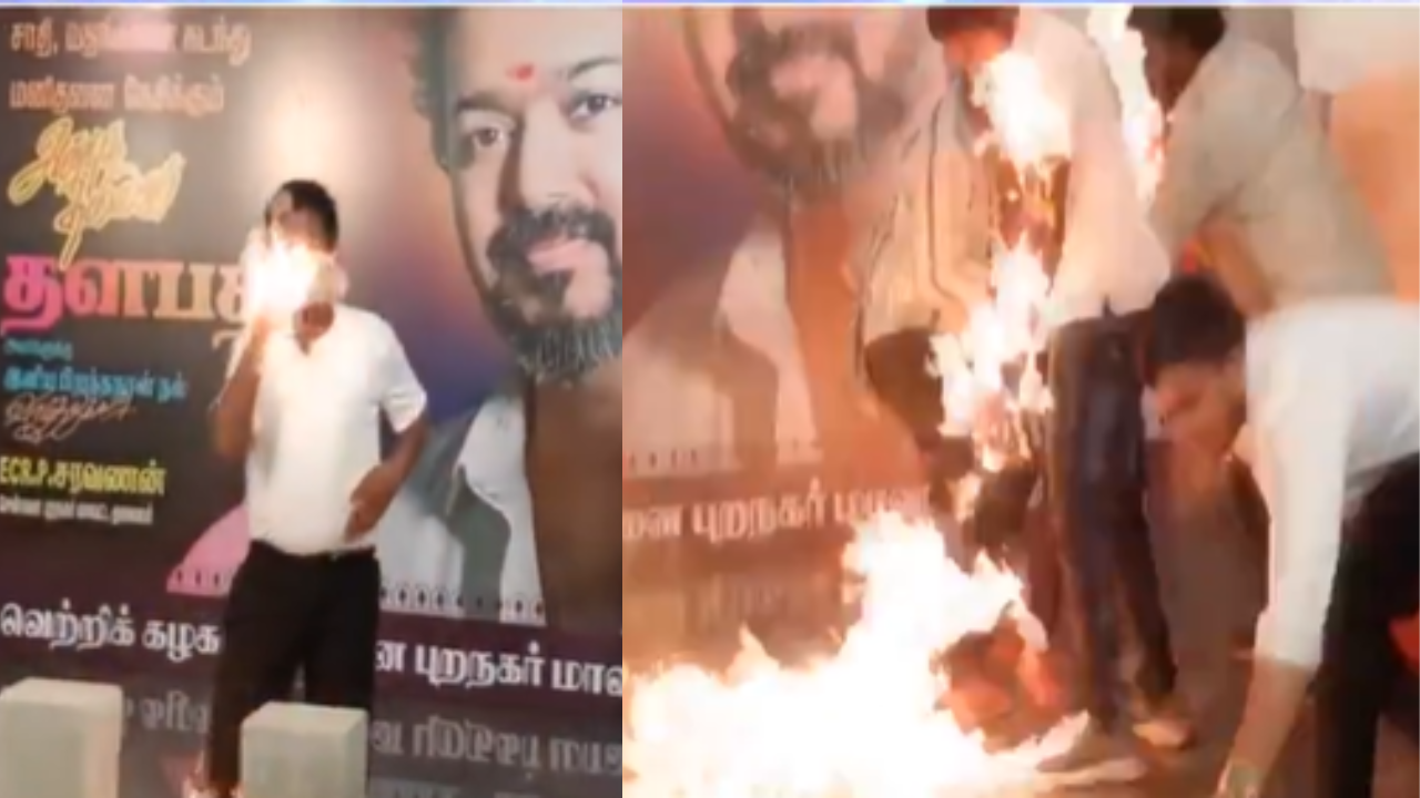 Chennai boy catches fire