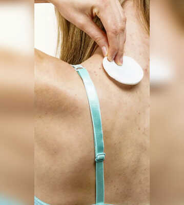 Tips To Get Rid Of Back Acne