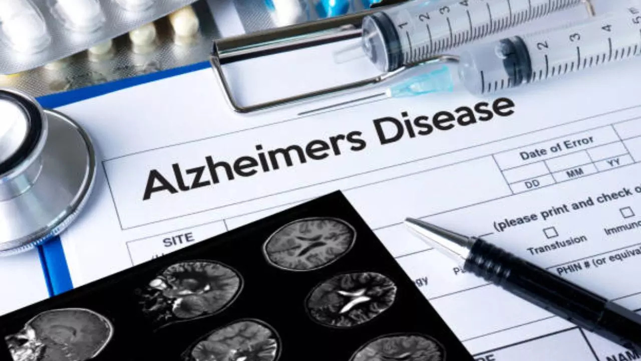 New AI Model Predicts Alzheimer's Disease From Speech