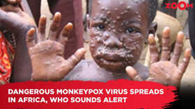 Dangerous monkeypox virus spreads in Africa WHO sounds alert