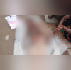 Stray Dogs Kill 8-Year-Old Boy In Telanganas Sangareddy