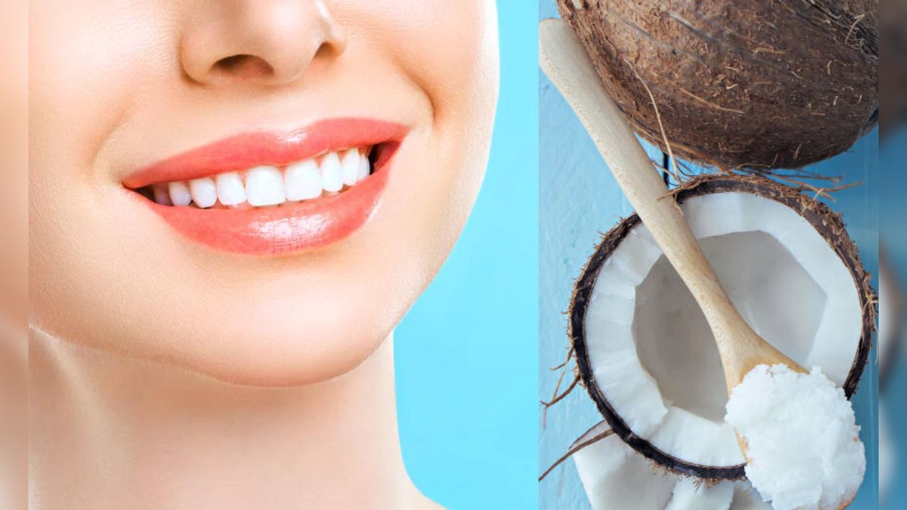 uses of  coconut oil for teeth whitening and other dental problems