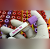 Zika Virus Cases In Pune Rise To 6 After Two Pregnant Women Test Positive For Infection