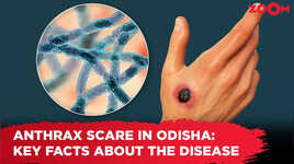 Anthrax outbreak in Odisha Key facts about the disease