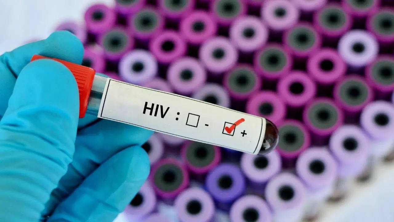 47 Students Die Due To HIV In Tripura, 828 Test Positive