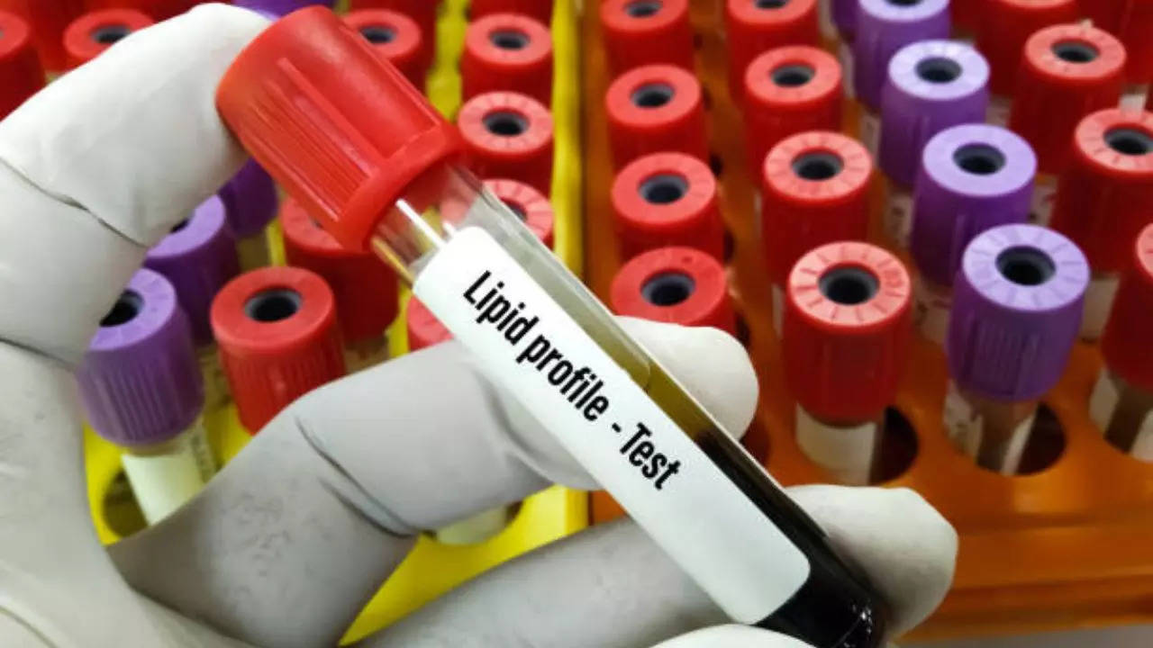 Cholesterol levels testing at the age of 18 years