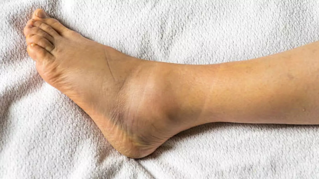 What causes swelling in ankles