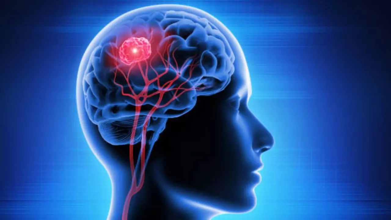 Surprising signs of brain tumours