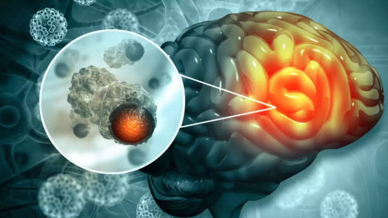 Woman's menopause treatment causes brain tumour