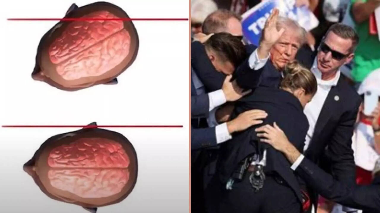  ஒரு நொடியில் மரணத்தை வென்ற டிரம்ப்... தலையை திருப்பியதால் காதை துளைத்த குண்டு.. உயிர் தப்பியது எப்படி? 