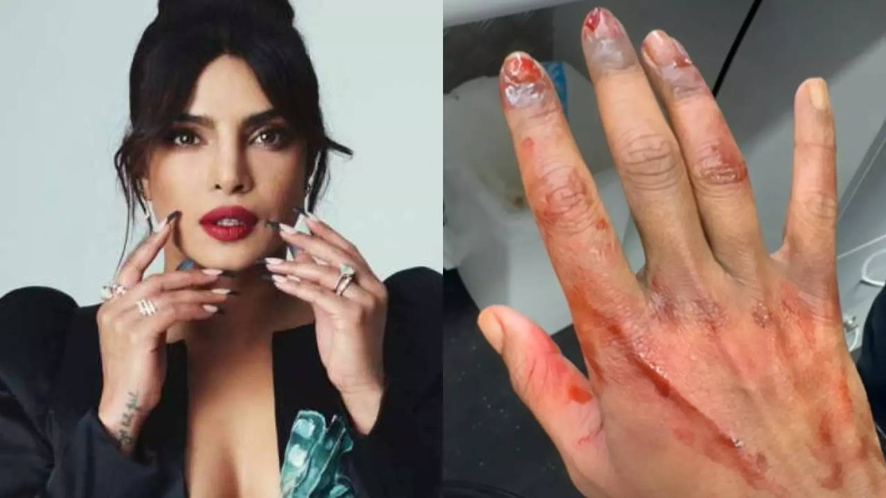 Priyanka Chopra Shocks Fans With Clip Of Injured Hand From The Bluff Sets, But There Is A Twist