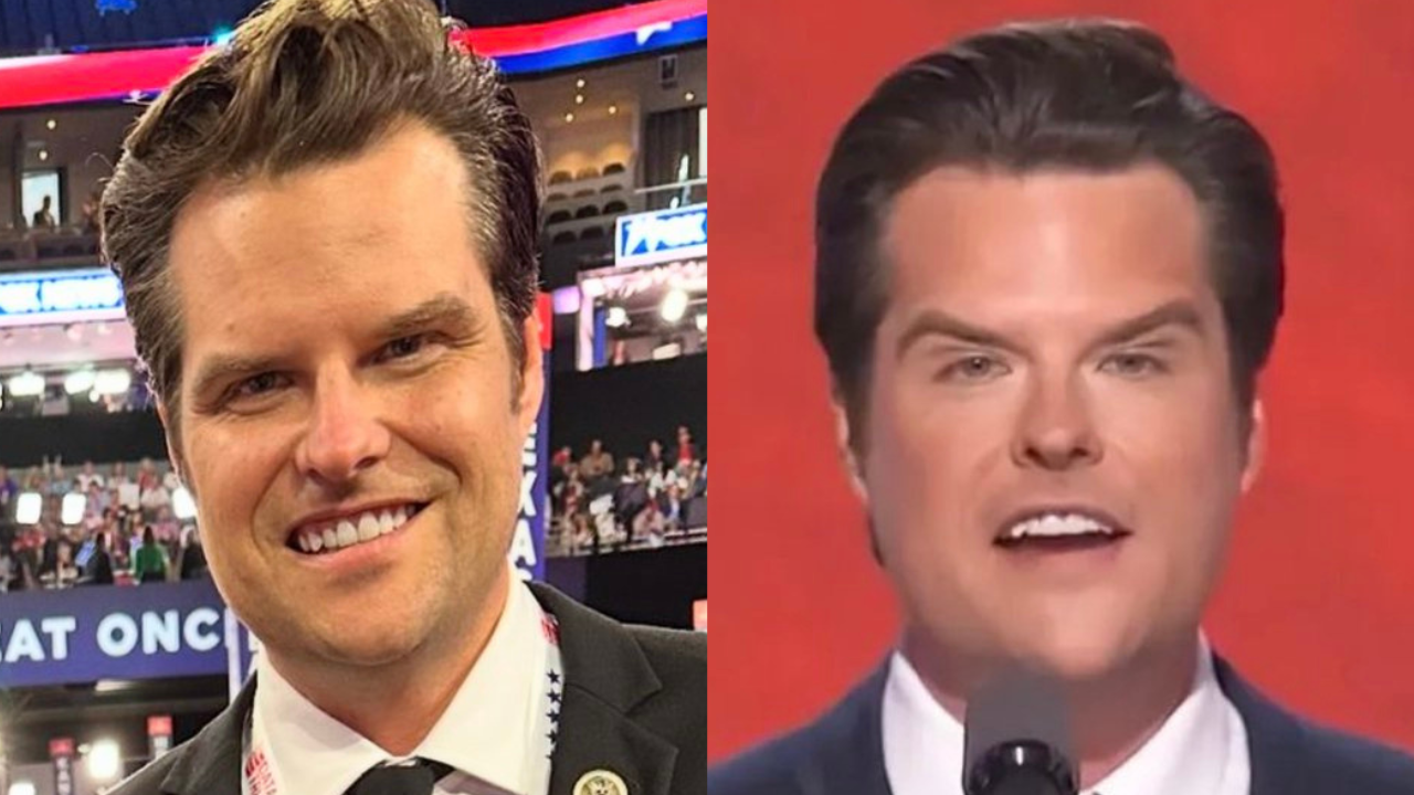 Matt Gaetz's 'Face Transformation' At RNC Sparks 'Botox' And 'Plastic