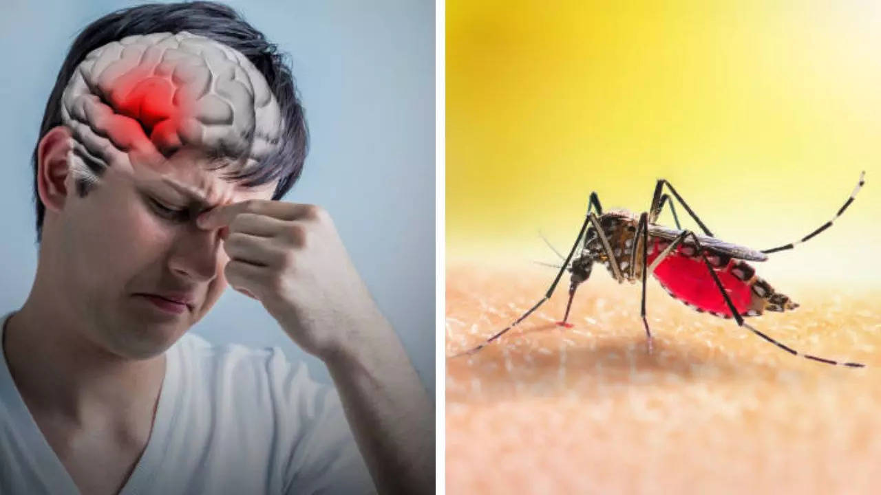 Dengue can cause brain stroke