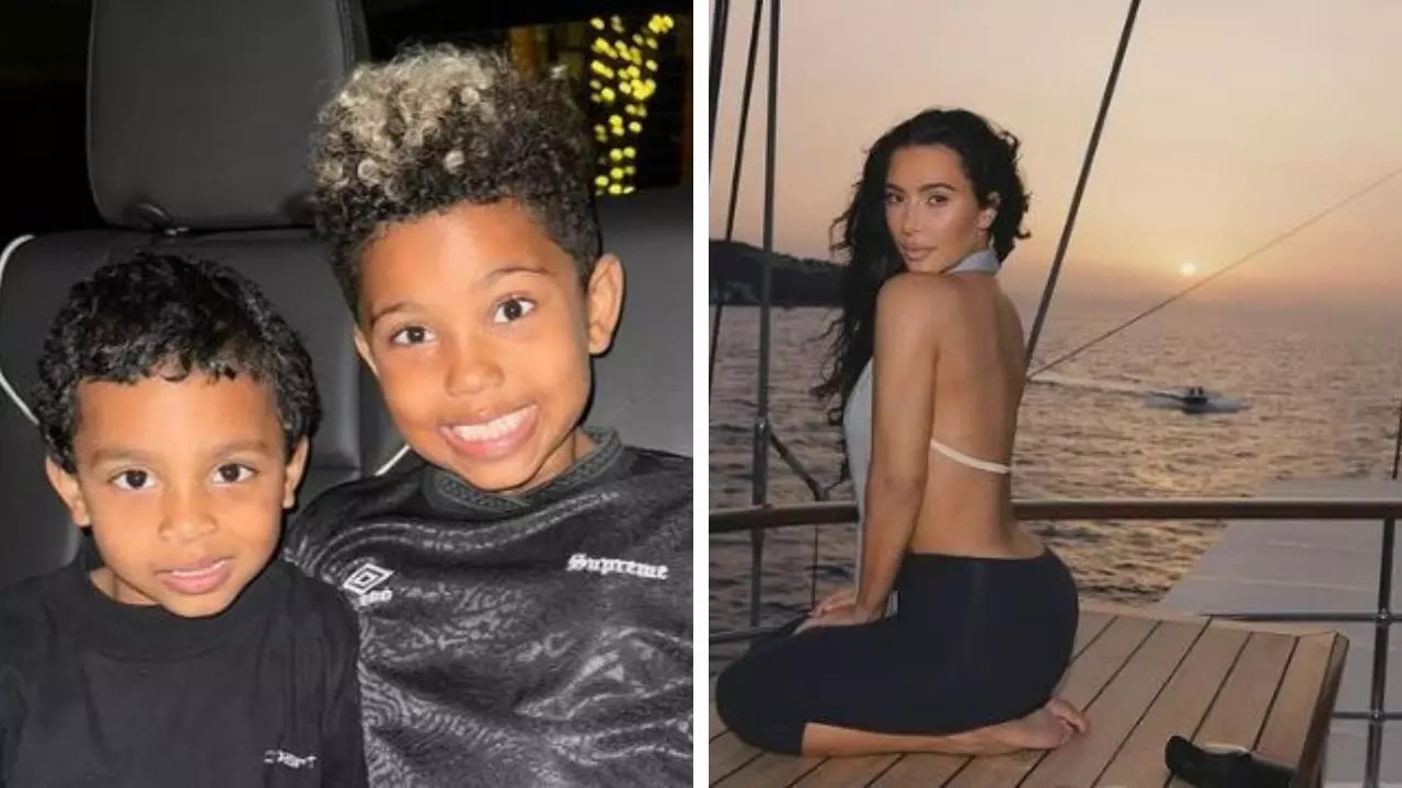 Kim kardashian's son suffers from vitiligo