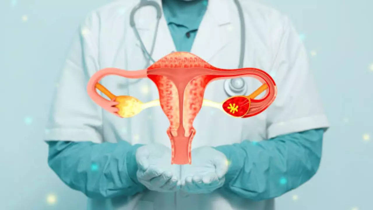 Women with endometriosis four times more likely to develop ovarian cancer 