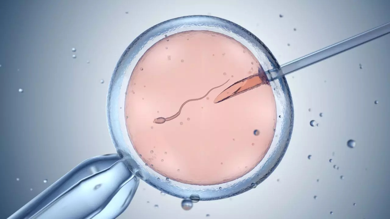 IVF