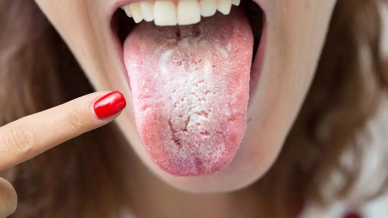 ​Know What Your Tongue’s Appearance Says About Your Health ​