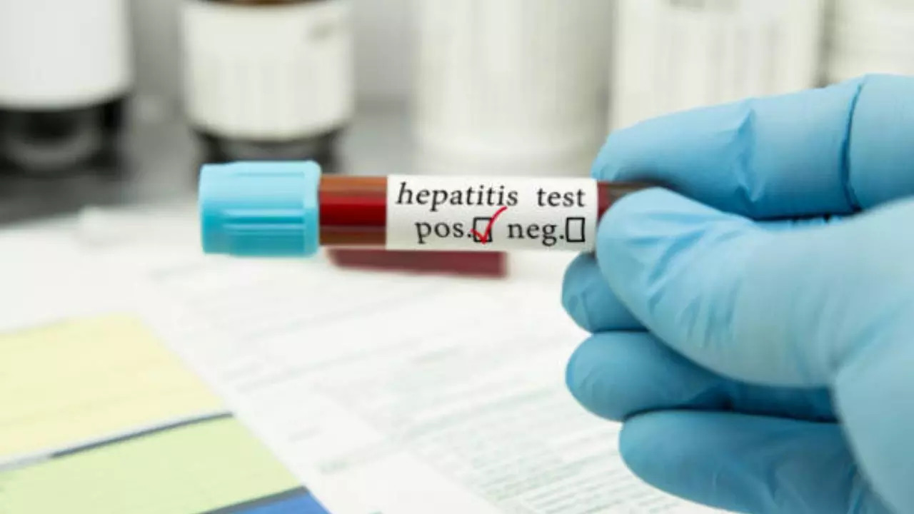 World Hepatitis Day 2024: Expert Shares Who Is More Prone To Get Infected