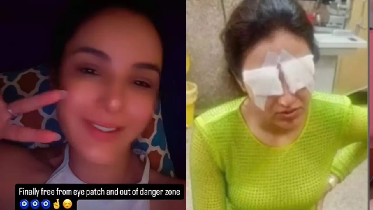 Jasmin Bhasin Gets Eye Patched Removed After Eye Injury: 'Finally Free'