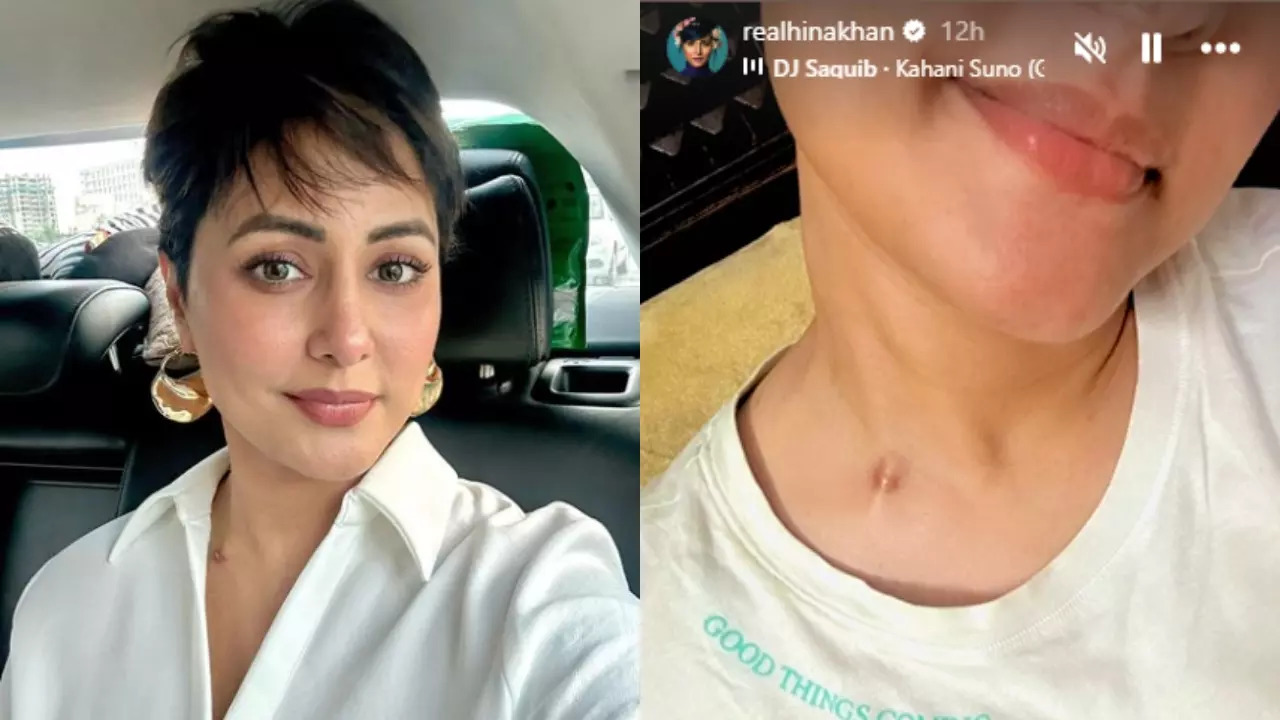 Hina Khan Boldly Shows Her Scars From Chemotherapy, Says ‘Good Things Coming’