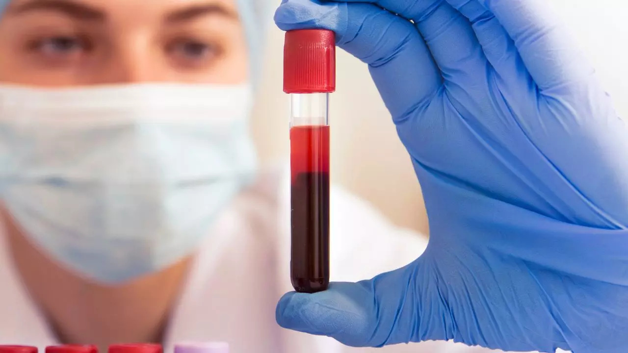 Blood Test For Colon Cancer Screening Approved By FDA