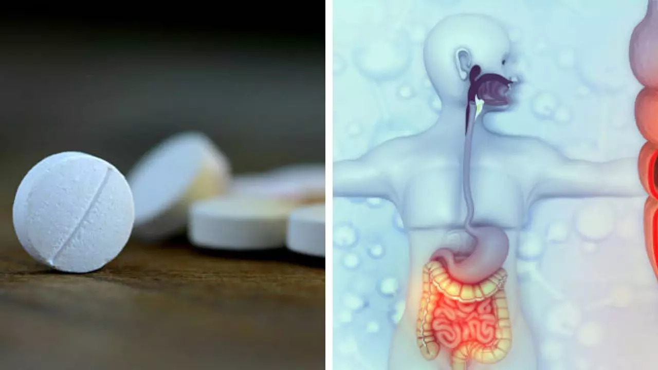 Aspirin lowers chances of colorectal cancer