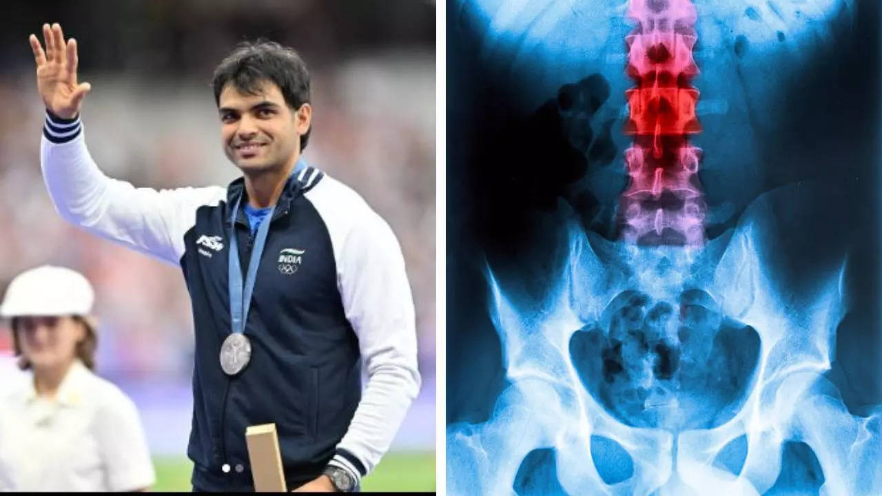 Neeraj Chopra struggling with groin hernia 